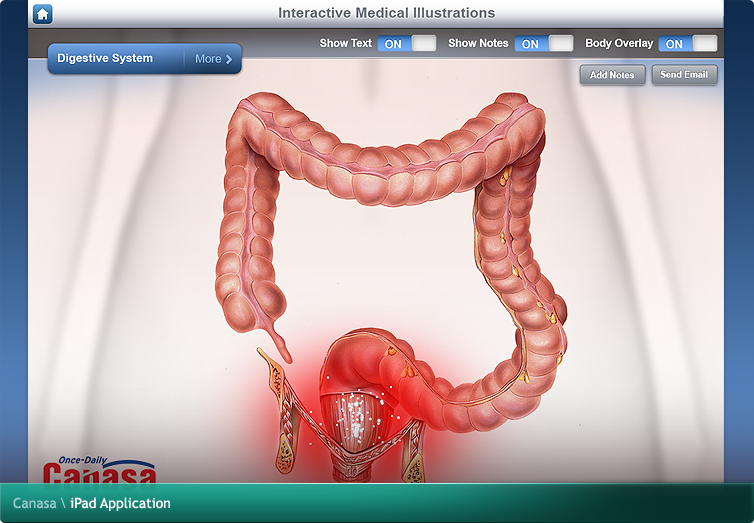 Canasa iPad Application