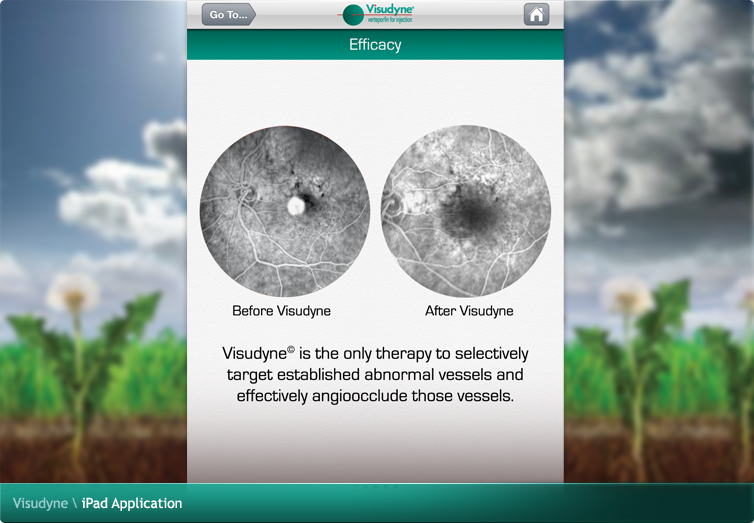 Visudyne iPad Application