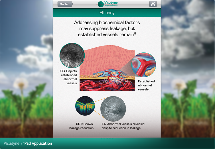 Visudyne iPad Application