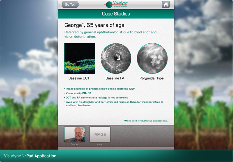 Visudyne iPad Application